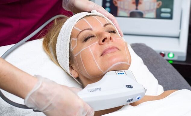 Ultrazvukový SMAS lifting pro nechirurgický lifting obličeje