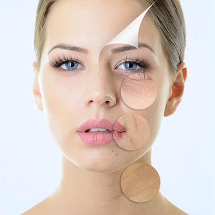 Nedokonalosti pleti obličeje - indikace pro procedury proti stárnutí
